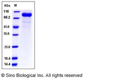 Sino Biological Influenza B (B/Malaysia/2506/2004) Hemagglutinin / HA Protein