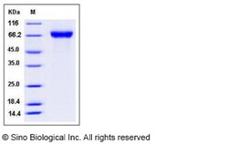 Sino Biological Influenza A H5N8 (A/duck/NY/191255-59/2002) Hemagglutinin