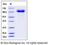 Sino Biological Influenza A H15N8 (A/duck/AUS/341/1983) Hemagglutinin /