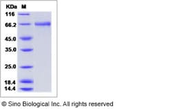 Sino Biological Influenza A H8N4 (A/pintail duck/Alberta/114/1979) Hemagglutinin