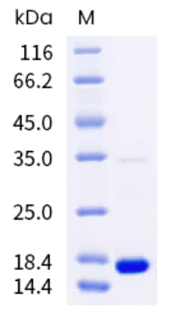 Sino Biological Human IFN gamma Protein 1mg, Quantity: Each of 1