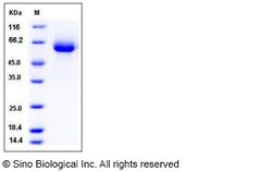 Sino Biological Recombinant Human VNN2 Protein (His Tag), Quantity: Each