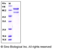 Sino Biological Recombinant Human CaMKII beta/CAMK2B Protein (His & GST