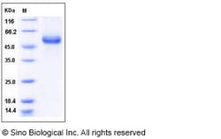 Sino Biological Human HAI-1 / SPINT1 Protein (His Tag) 50ug, Quantity: