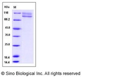 Sino Biological Recombinant Human IL-17RC Protein (hFc Tag) 1, Quantity: