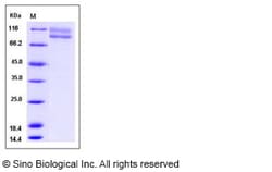 Sino Biological Recombinant Human IL-17RC Protein (hFc Tag), Quantity: