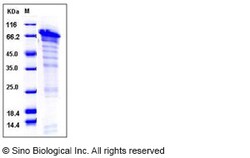 Sino Biological Human SIRT1 / SIR2L1 Protein (His Tag) 100ug, Quantity: