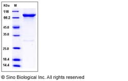 Sino Biological Recombinant Human GRK6 Protein (His & GST Tag), Quantity:
