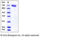 Sino Biological Recombinant Human GRK2 Protein (His & GST Tag), Quantity: