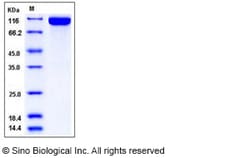 Sino Biological Recombinant Human DPP10 Protein (His Tag), Quantity: Each