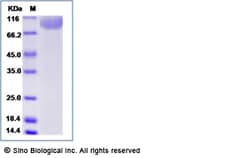 Sino Biological Human GP1BA Protein (His Tag) 50ug, Quantity: Each of 1