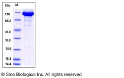 Sino Biological Recombinant Human ATP citrate lyase/ACLY Protein (His Tag),