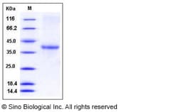 Sino Biological Recombinant Human ACRV1 Protein (His Tag), Quantity: Each