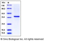 Sino Biological&nbsp;Recombinant Human Collagen II/COL2A1 Protein (aa 1242-1487, His Tag)