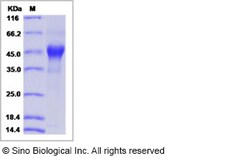 Sino Biological Protein Human CSF1 50ug, Quantity: Each of 1