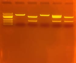 EDVOTEK™ Cholesterol Diagnostics with SYBR™ Safe