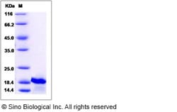 Sino Biological Human IL7 / interleukin 7 Protein 10ug, Quantity: Each