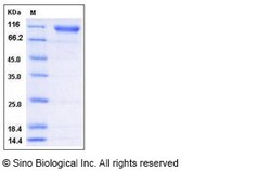 Sino Biological Human Semaphorin 4D / SEMA4D / CD100 Protein (His Tag)