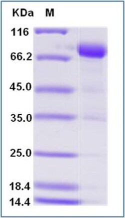 Sino Biological Human SIRP gamma Protein (Fc Tag) 200ug, Quantity: Each