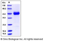 Sino Biological Recombinant Human SIRP gamma/SIRPG Protein (ECD, His Tag),