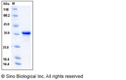 Sino Biological Human TWF1 / PTK9 / Twinfilin-1 Protein 100ug, Quantity: