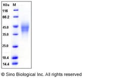 Sino Biological Recombinant Human CD300C/LMIR2 Protein (His Tag), HPLC-verified,