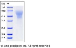 Sino Biological Recombinant Human C4.4A/LYPD3 Protein (His Tag), HPLC-verified
