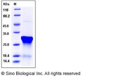 Sino Biological Recombinant Human CNTF Protein (His Tag), Quantity: Each