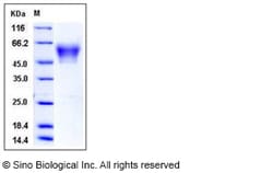 Sino Biological Recombinant Human Neurexin-3 beta/NRXN3 Protein (His Tag),