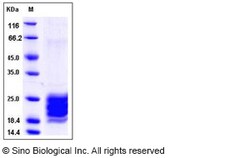 Sino Biological Human IL-9 / Interleukin-9 Protein (His Tag) 20ug, Quantity: