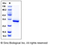 Sino Biological Recombinant Human EDA2R/TNFRSF27 Protein (His Tag), Quantity: