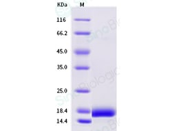 Sino Biological Human IL4 / Interleukin-4 Protein, Biotinylated 20ug, Quantity: