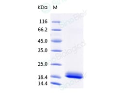 Sino Biological Human IL2 Protein, Low Endotoxin 1mg, Quantity: Each of