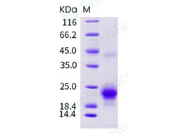 Sino Biological Recombinant Human IL-17F Protein (His Tag) 1, Quantity: