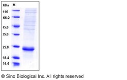Sino Biological Recombinant Human IL-17F Protein (His Tag), Quantity: Each