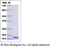 Sino Biological Recombinant Human IL-17F Protein, Quantity: Each of 1