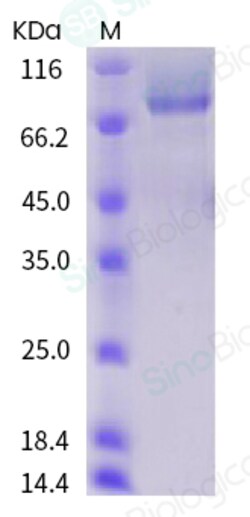 Sino Biological Human Thrombomodulin / THBD Protein (His Tag) 50ug, Quantity: