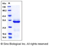 Sino Biological Protein Human PRSS3 50ug, Quantity: Each of 1