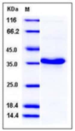 Sino Biological Recombinant Human HABP1/C1QBP/gC1qR Protein (His Tag),
