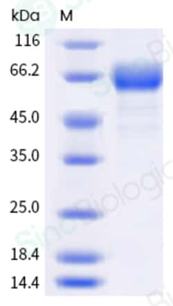 Sino Biological Recombinant Human CD19 Protein (ECD, hFc Tag), Quantity: