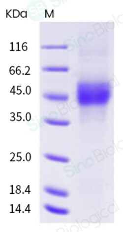 Sino Biological Recombinant Human CD19 Protein (ECD, His Tag), Quantity: