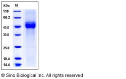 Sino Biological Recombinant Human CD19 Protein (His Tag), Amine-Labeled