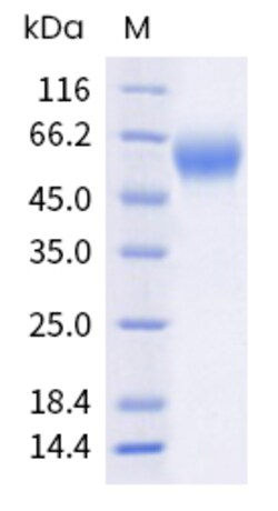 Sino Biological Recombinant Human CD19 Protein (ECD, His & AVI Tag), Biotinylated,