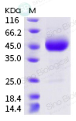 Sino Biological Recombinant Human BTLA Protein (ECD, mFc Tag), Quantity: