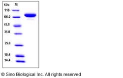 Sino Biological Recombinant Human XPNPEP2 Protein (His Tag), HPLC-verified,