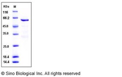 Sino Biological Recombinant Human MUSK Protein (aa 433-783, His & GST Tag),