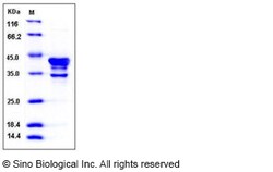 Sino Biological Recombinant Human CAMKI Protein, Quantity: Each of 1