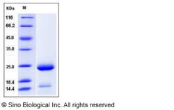 Sino Biological Recombinant Human TLT-1/TREML1 Protein (His Tag), HPLC-verified,