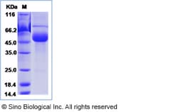 Sino Biological Recombinant Human FSH Beta Protein (hFc Tag), Quantity: