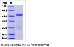 Sino Biological Recombinant Human IL17B Protein (hFc Tag), Quantity: Each